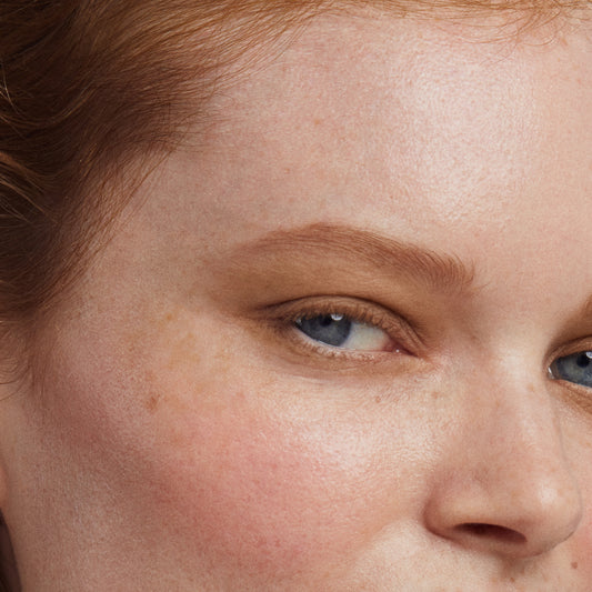 close up of a person’s face with a fair skin tone wearing cream blush 
